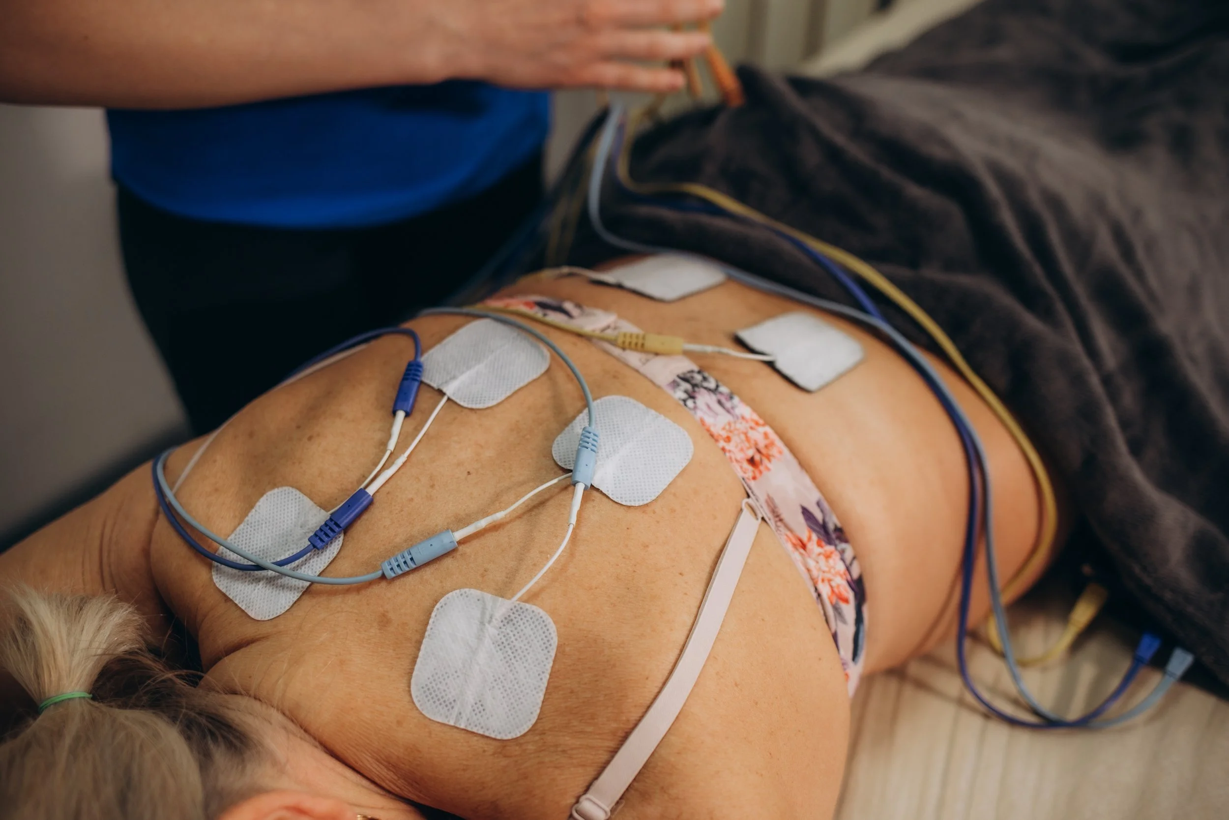 Person receiving electrotherapy treatment with electrode pads placed on the lower back.