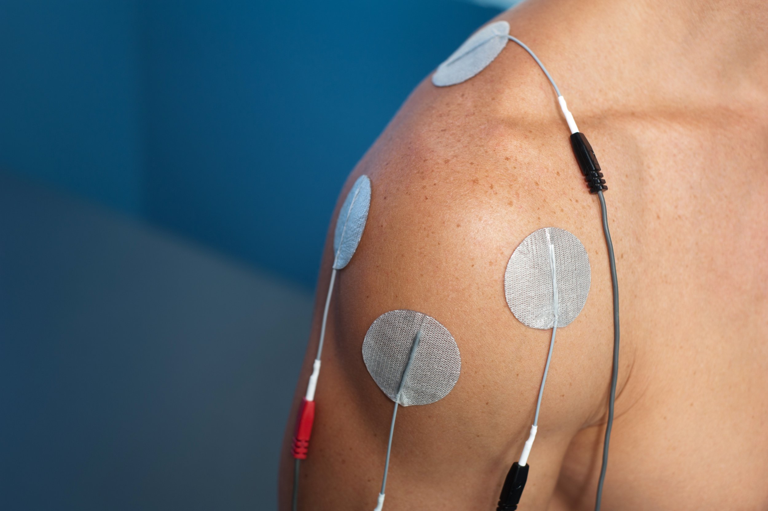 Electric Muscle Stimulation (EMS) at Keep It Kinetic Chiropractic